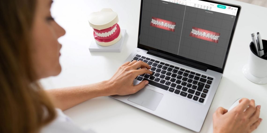 خطة علاج متكاملة للأسنان من ايون دنتال